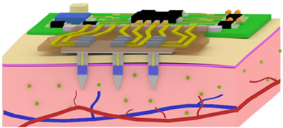 微介入式传感器原理模型