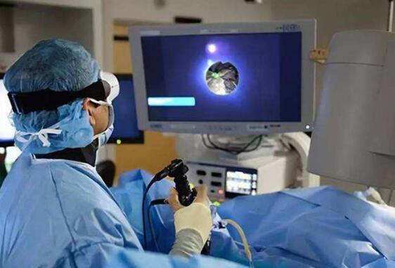 用于激光碎石过程压力和温度监控设备中的光纤传感器