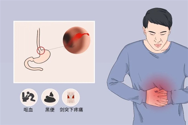 小伙被起哄吹完1瓶大扎啤呕血1升