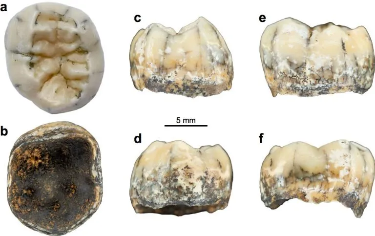TNH2-1-Tooth-Specimen-768x483.webp