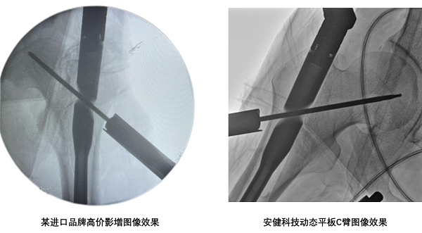 安健科技：低剂量动态平板C臂普及者